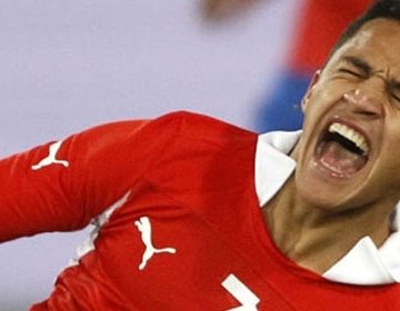 ¡Terrible! Así luce el pie de Alexis Sánchez hoy