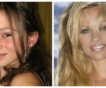 Le hicieron bullying, se operó para verse como Pam Anderson y el resultado tiene loco a varios