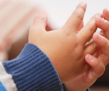 Mamá del año les quemó las manos a sus retoños por comerse su comida chatarra