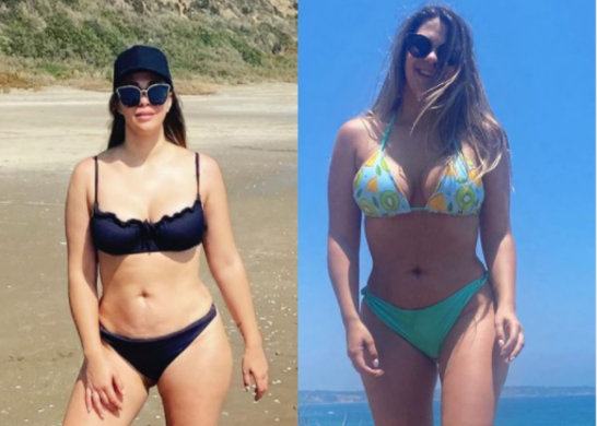 Laura Prieto antes y después