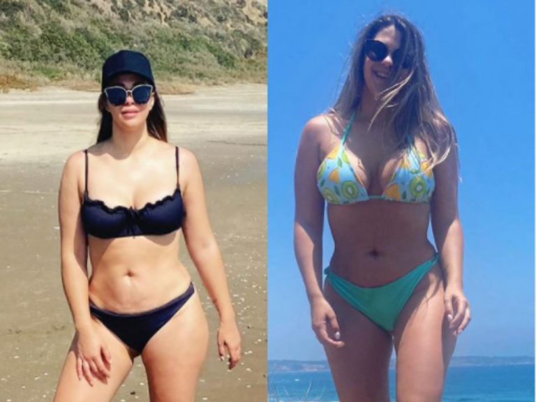 Laura Prieto antes y después