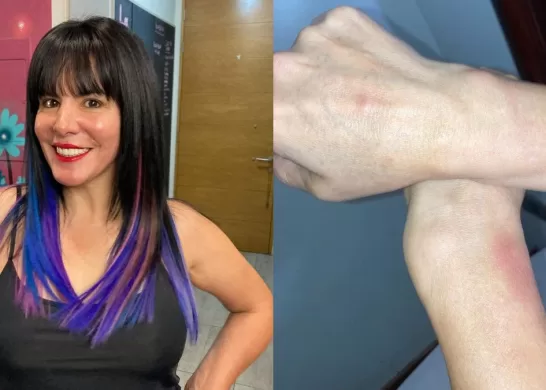 Anita Alvarado Rompe El Silencio