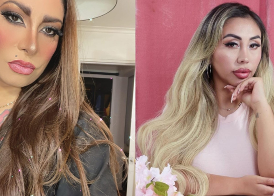 Botota Fox Y Naya Facil