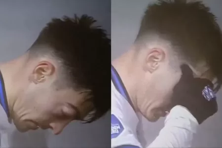 Futbolista Se Le Sale El Ojo