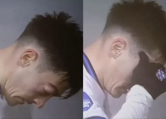 Futbolista Se Le Sale El Ojo