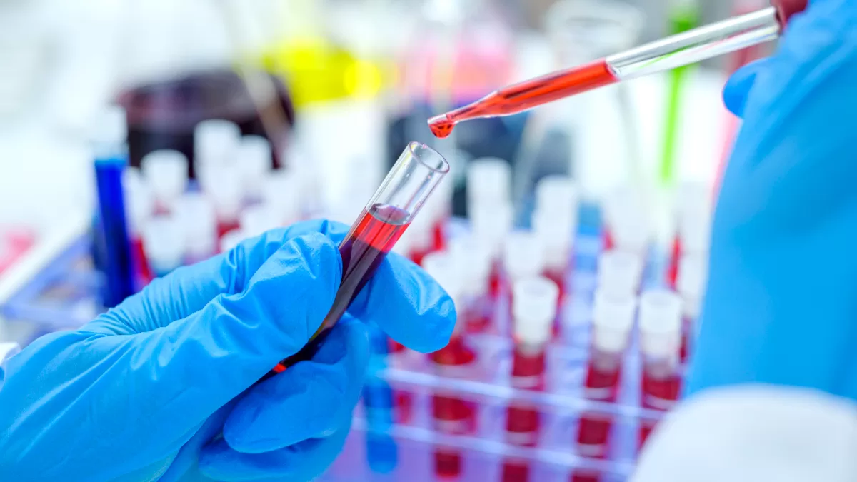 ¿Qué separa al VIH del SIDA? Conoce AQUÍ las diferencias según expertos ...