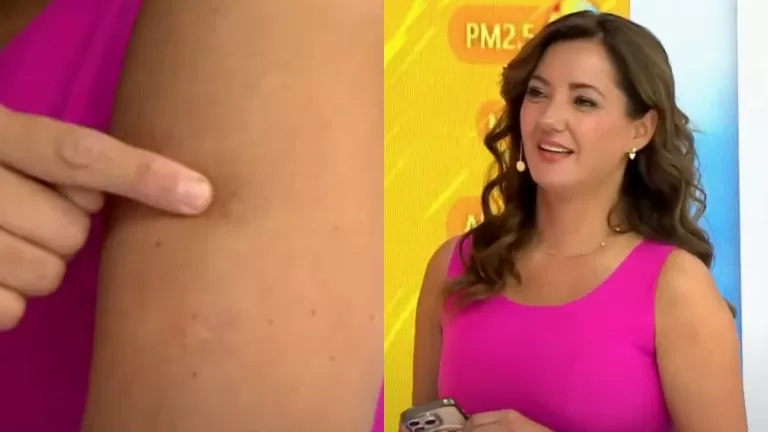 Priscilla Vargas Tumor Brazo