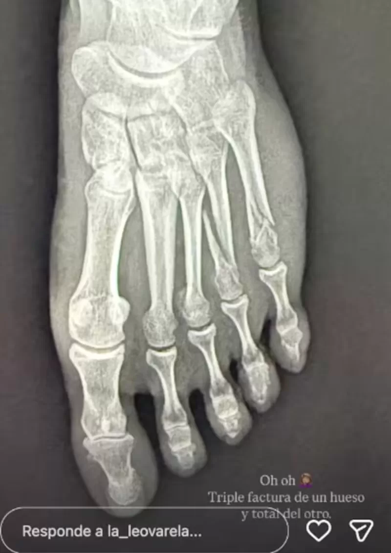 Instagram@la_leovarela