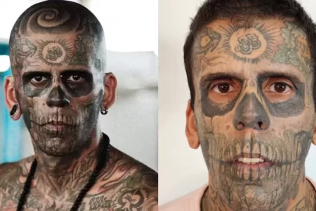 Asú Luce Ahora Leandro De Souza Tras Sacarse Los Tatuajes