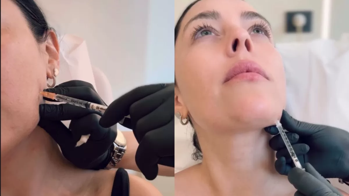 Daniela Aránguiz Tratamiento Estetico