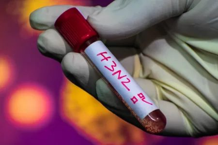 Primer Caso De Influenza En Chile