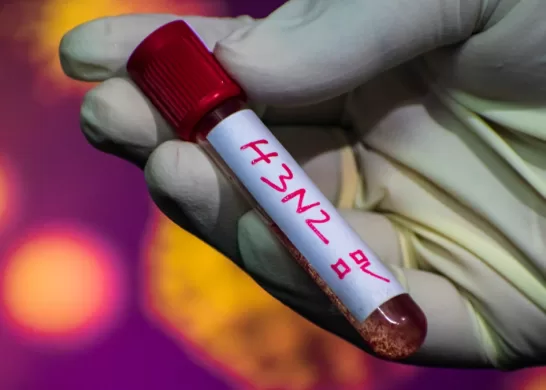 Primer Caso De Influenza En Chile