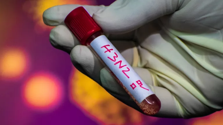 Primer Caso De Influenza En Chile