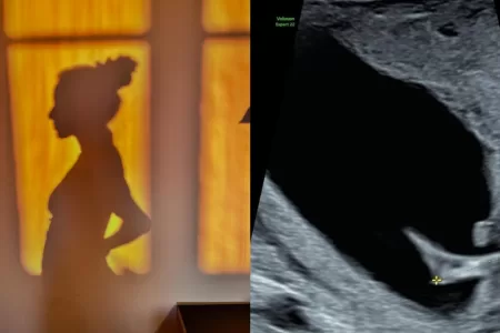 Embarazo Anto Giesen