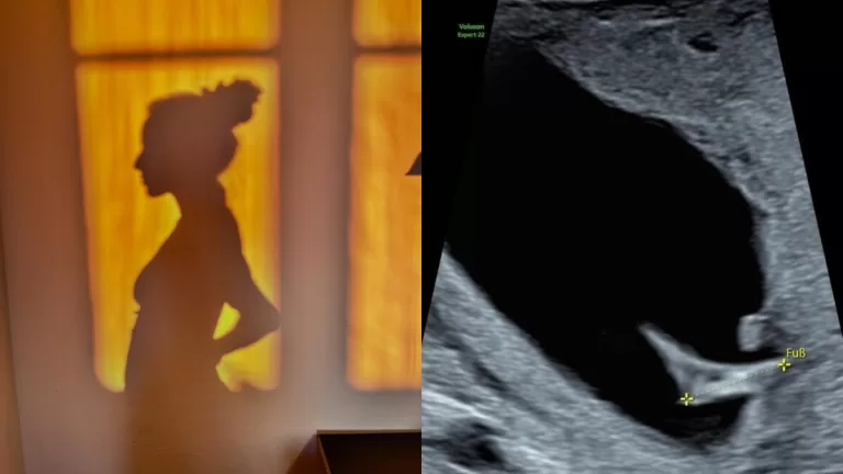 Embarazo Anto Giesen