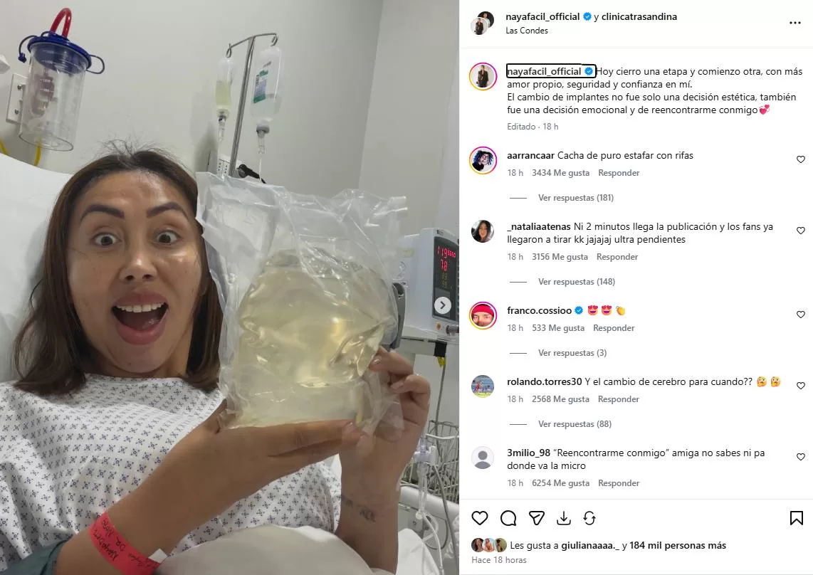 Instagram_ Naya Fácil