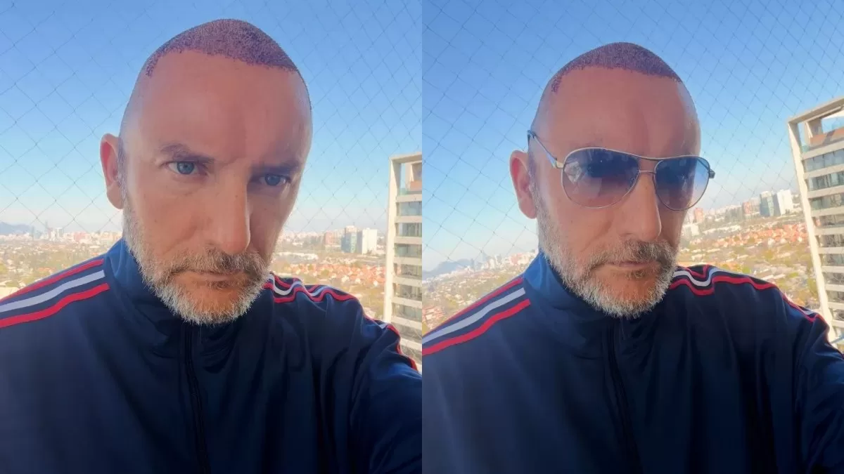 Instagram Exhuevo